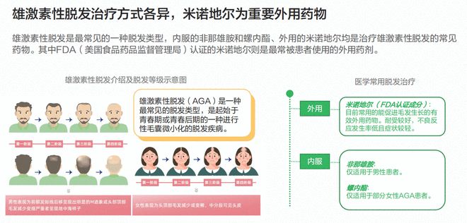 世界脱发研究最新进展